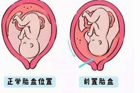 在湘潭做试管可以报销医保吗？湖南是挂报销政策解读