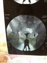 2026粤北人民医院试管婴儿成功率一览，附试管医生推荐